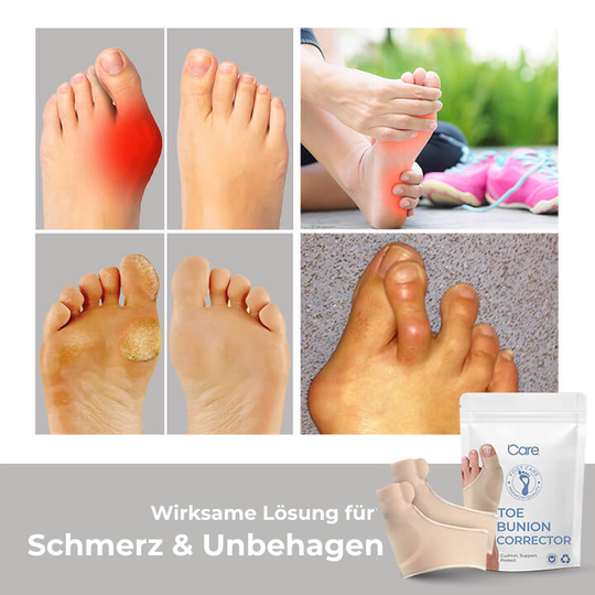 Footalis FlexAlign | Zehenspreizer für Hallux Valgus | Hautfreundlich & Diskret | Für Tag & Nacht