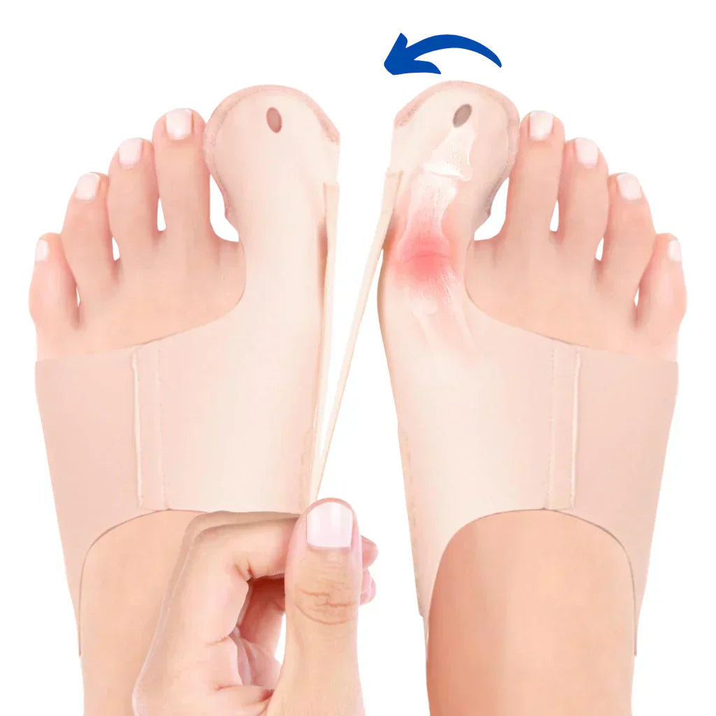 OrthoFlex – Schmerzfreie Schritte bei Hallux Valgus!