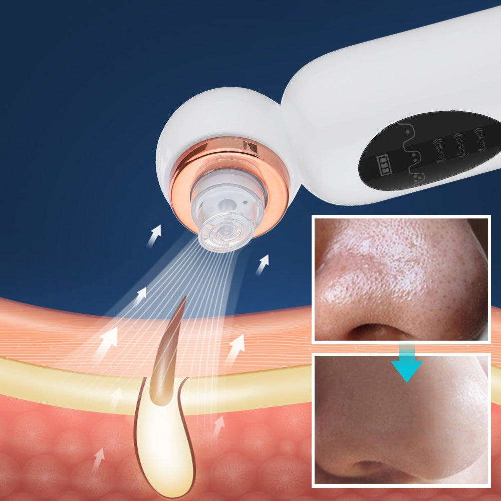 PureSkin Pro | Hydrodermabrasion | Mitesserentferner | Tiefenpflege