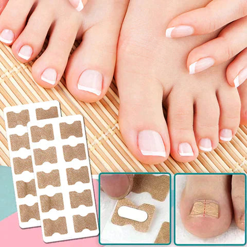 10+10 GRATIS | FixaNail - Sofortige Nagelreparatur