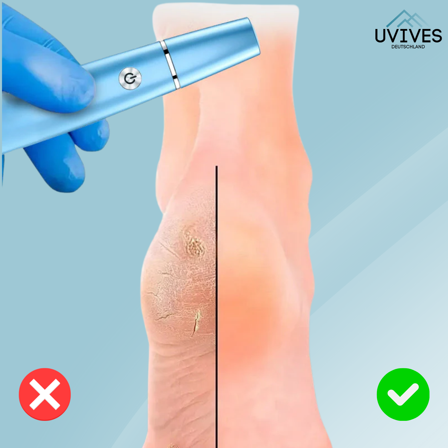 SilkaFeet™ – Mühelos glatte und gepflegte Füße