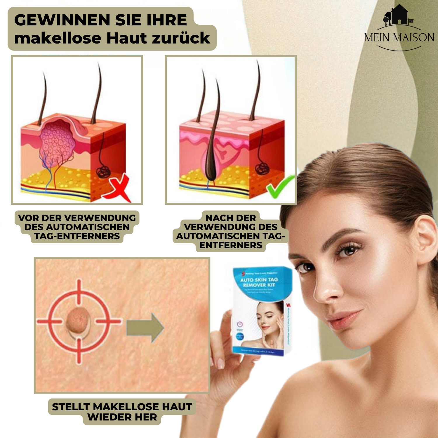 Clarina SkinClear | Warzen- & Muttermalentferner | Sanft & Effektiv | Für Gesicht & Körper