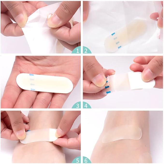 SootheStep - Unsichtbare Gel-Pads, die Blasen sofort stoppen