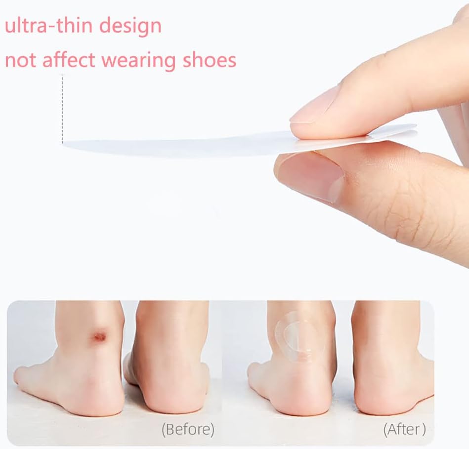 SootheStep - Unsichtbare Gel-Pads, die Blasen sofort stoppen