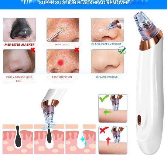 ClearGlow Pro | Vakuum-Porenreiniger für tiefenreine Haut | Mitesserentfernung & Hautglättung | Kabellos & Wiederaufladbar