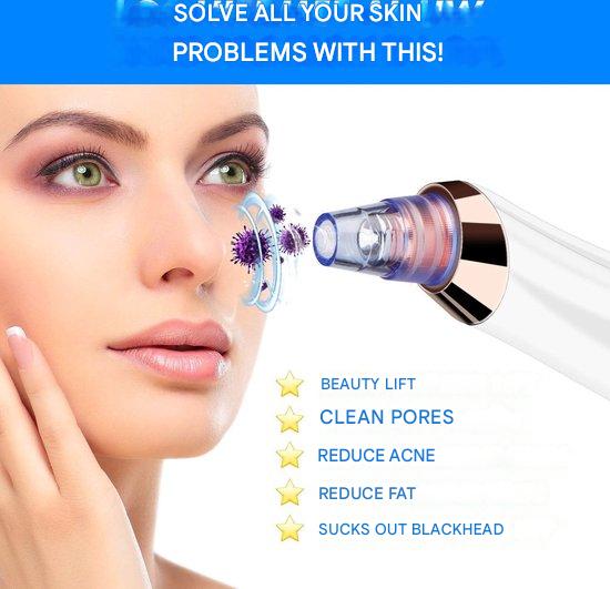ClearGlow Pro | Vakuum-Porenreiniger für tiefenreine Haut | Mitesserentfernung & Hautglättung | Kabellos & Wiederaufladbar