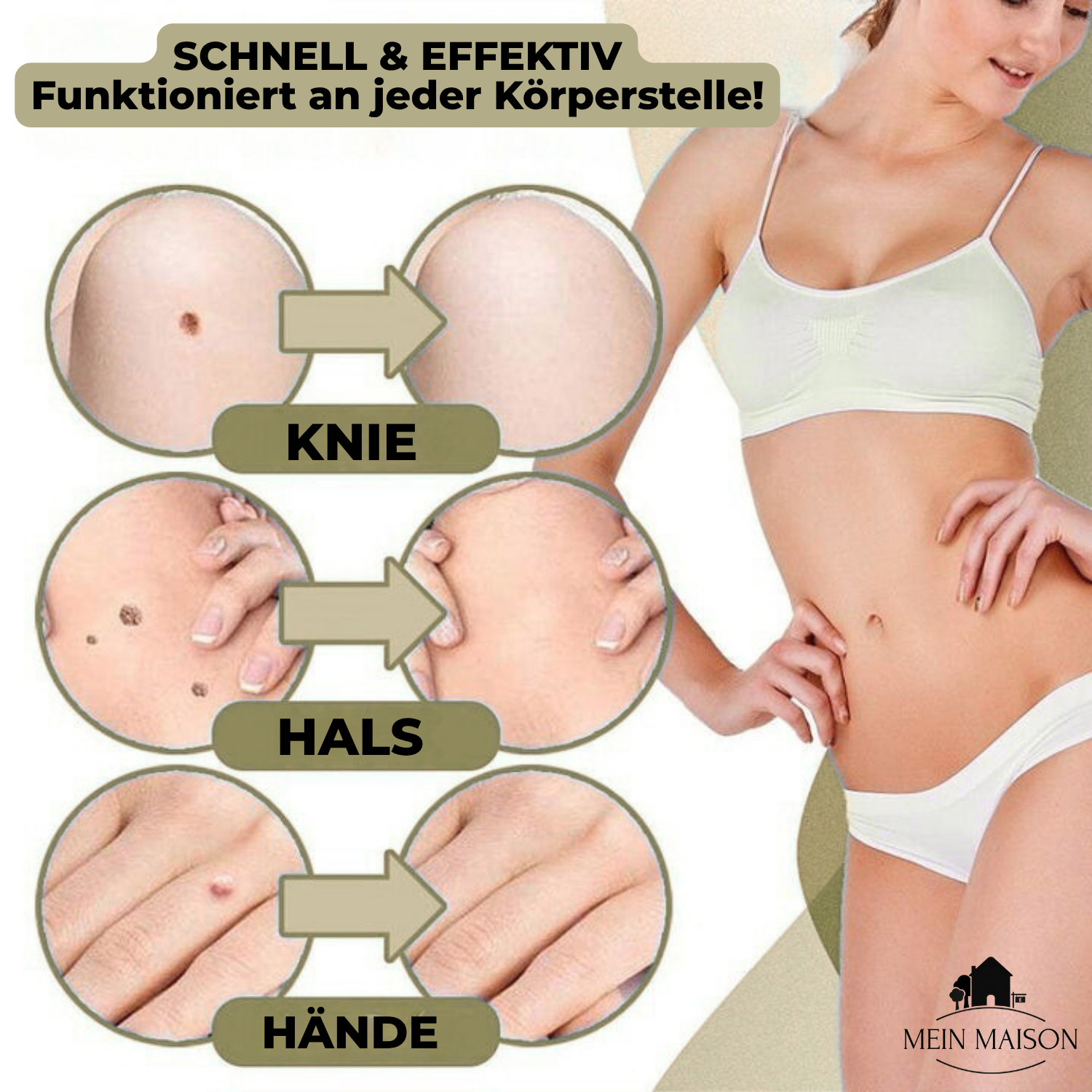 Clarina SkinClear | Warzen- & Muttermalentferner | Sanft & Effektiv | Für Gesicht & Körper