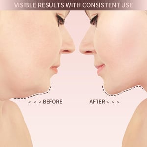 VitaLift™ – Straffe deine Gesichtszüge auf natürliche Weise