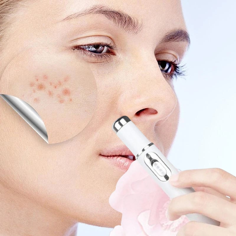 ClearDerm - Schmerzfreie Pickelentfernung für schnelle, glatte Haut