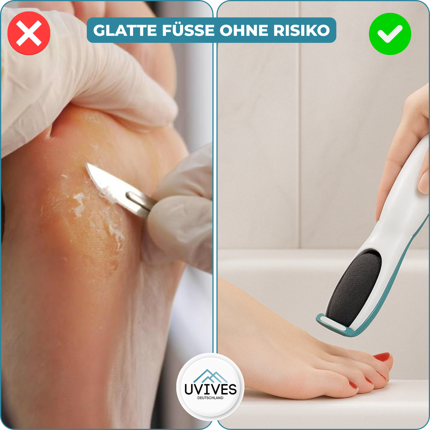 SilkaFeet™ – Mühelos glatte und gepflegte Füße