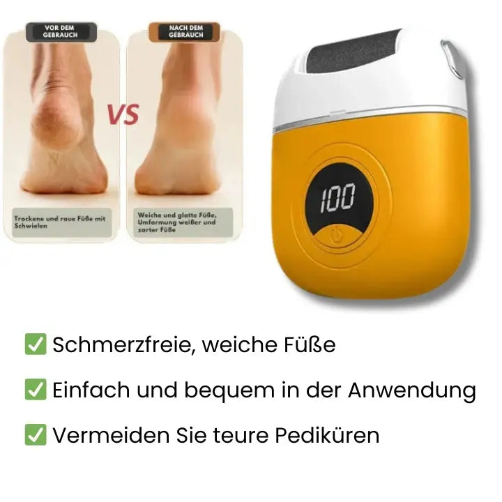 SmoothSole – Schmerzfreie Füße in nur wenigen Minuten
