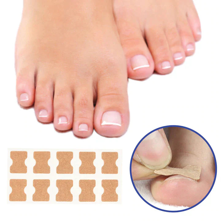 10+10 GRATIS | FixaNail - Sofortige Nagelreparatur