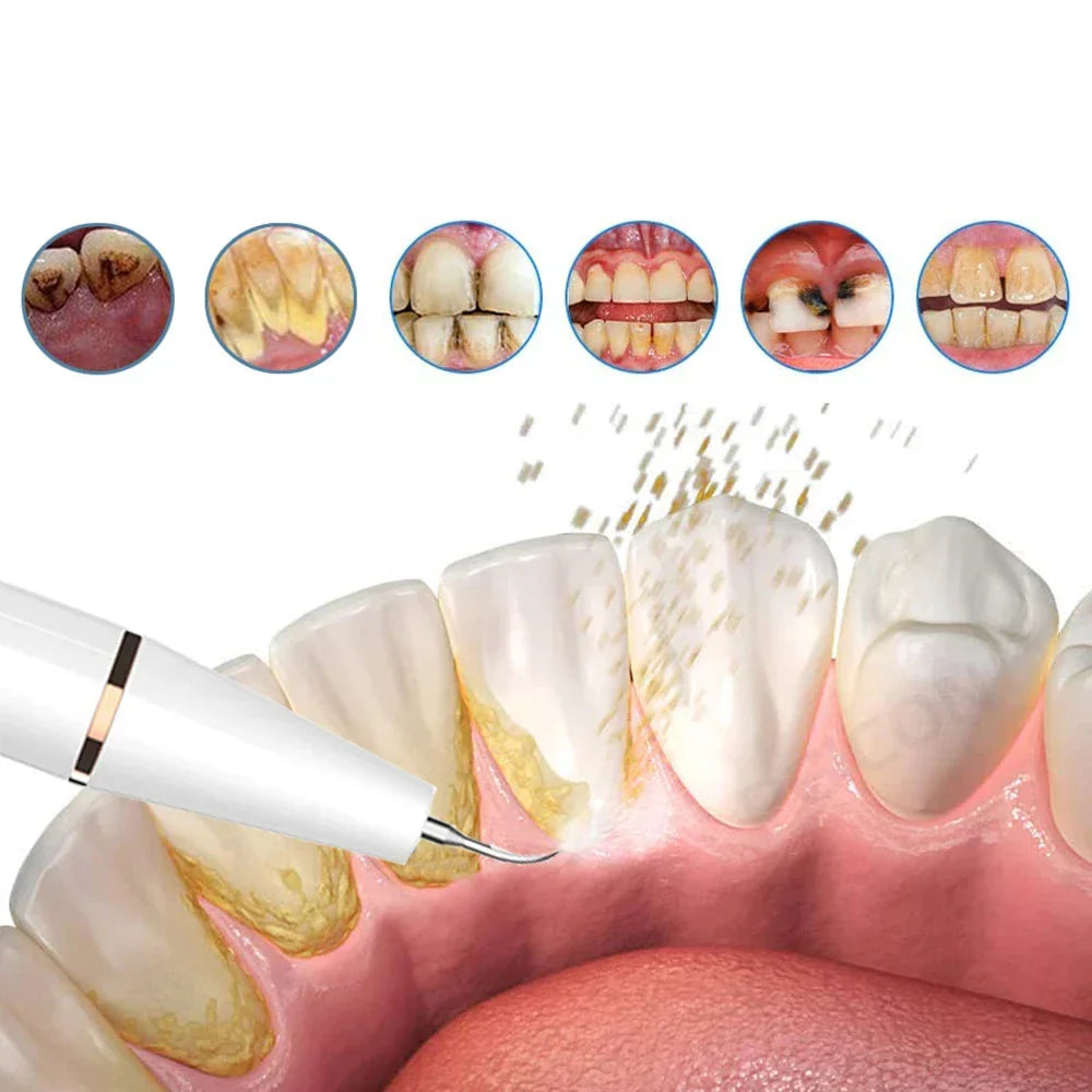 Dentaclear Sonic | Ultraschall Zahnreiniger | Kompakt & Effektiv | Für Zuhause & Reisen