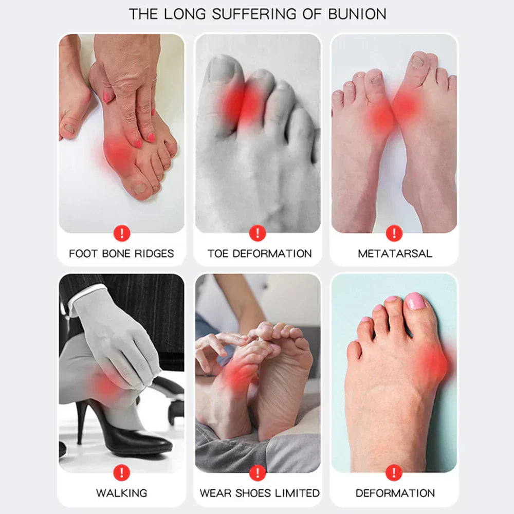 OrthoFlex – Schmerzfreie Schritte bei Hallux Valgus!