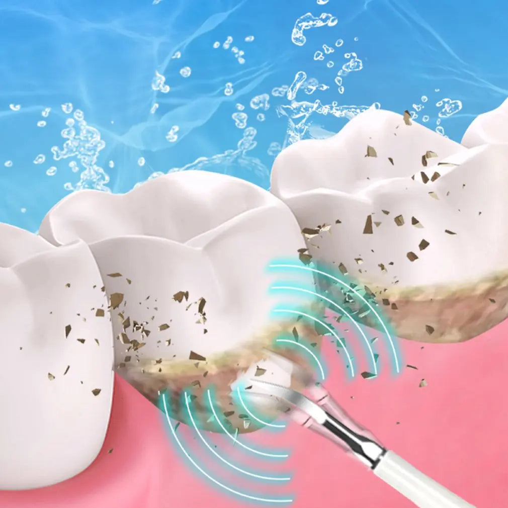 OralNova SonicPro | Schall-Zahnreiniger & Whitening-Irrigator | Plaque- & Zahnsteinentfernung | Für Strahlend Weiße Zähne