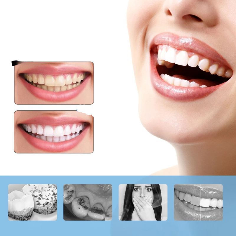 Zensmile UltraClean | 6-Stufen Schall-Zahnreiniger & Aufheller | Wasserfest & USB-C | Für Strahlend Weiße Zähne