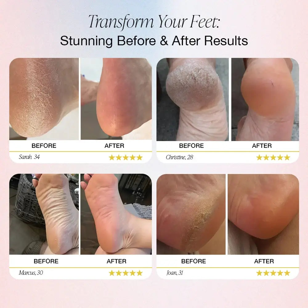 SoftFeet – Samtweiche Füße in Minuten, nicht Wochen!