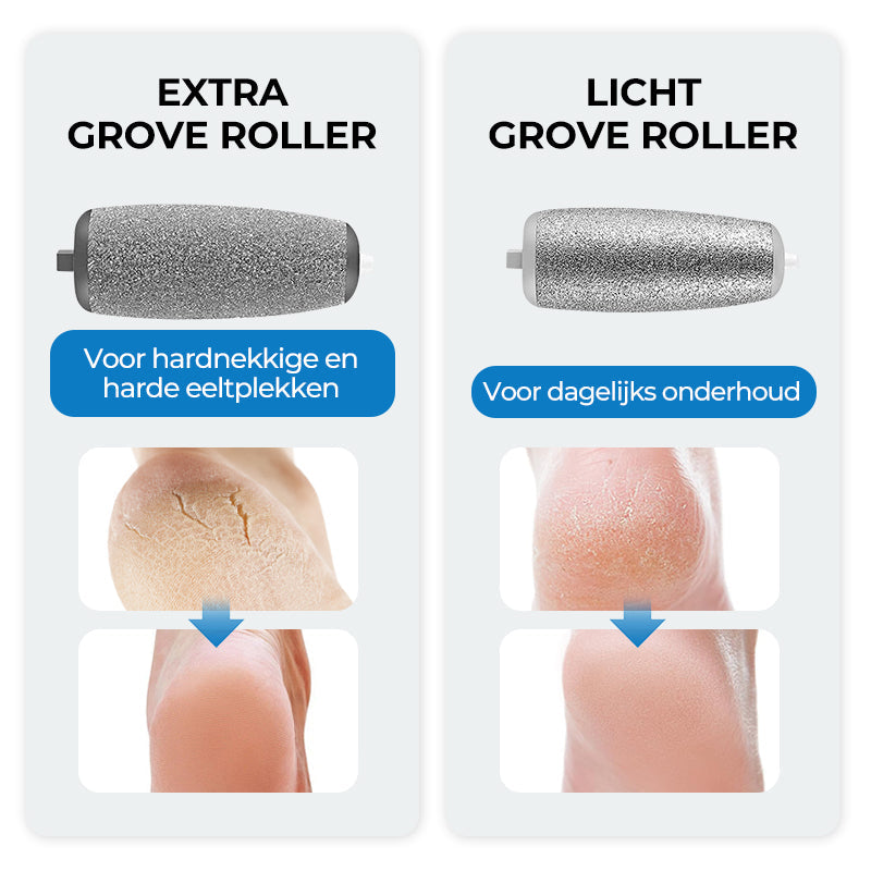 SmoothFoot – Seidenglatte Füße in nur wenigen Minuten