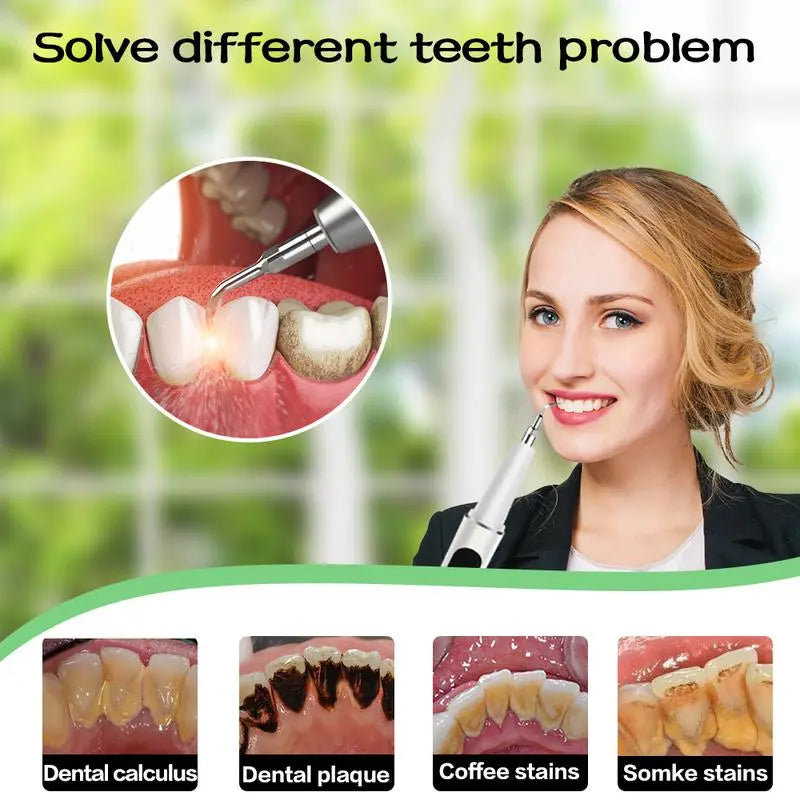 BrightWave - Professionelle Ultraschall-Zahnreinigung für ein strahlendes Lächeln