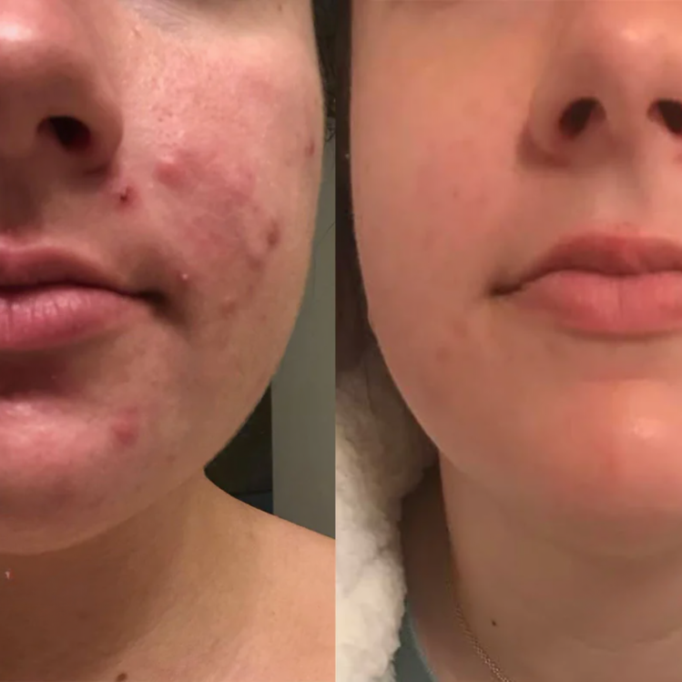 1+1 GRATIS | DermCare SkinGlow – Für makellos glatte Haut!