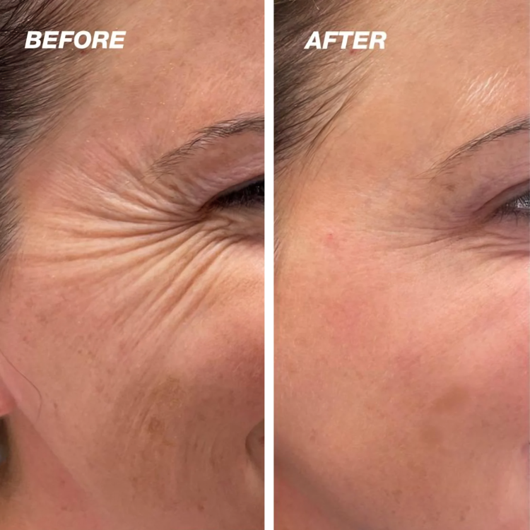 1+1 GRATIS | DermCare SkinGlow – Für makellos glatte Haut!
