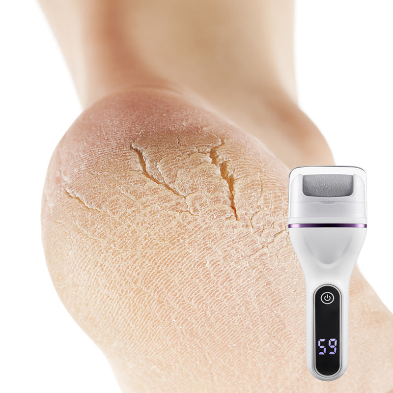 SoftStep Pro – Für samtweiche Füße in Minuten