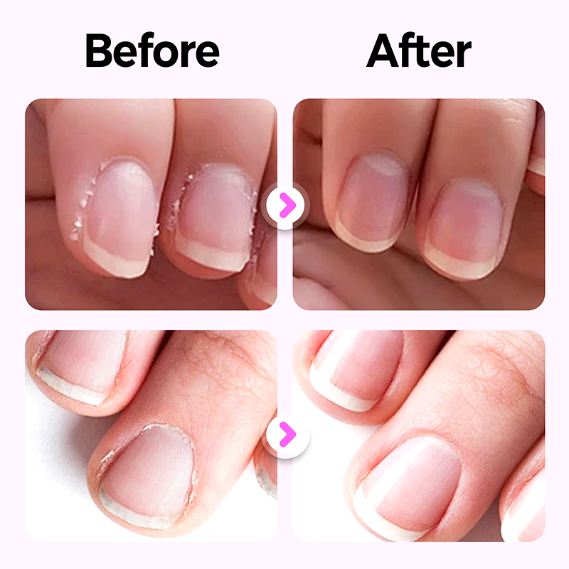 1+1 GRATIS | MagicNails – Pflege, Duft & Glanz in nur 1 Stift!